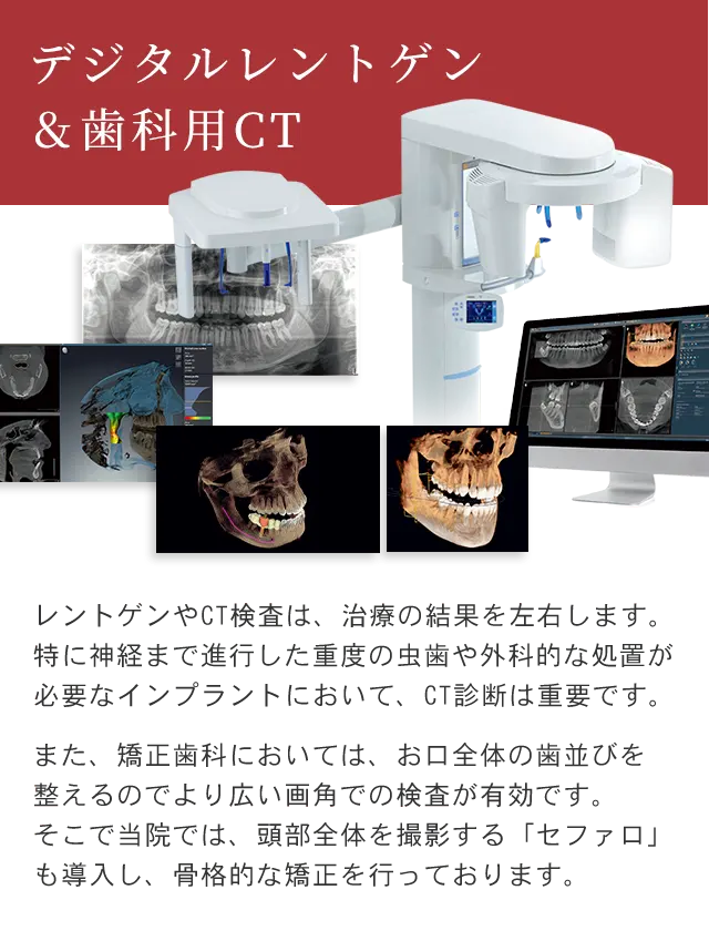 レントゲン・歯科用CT