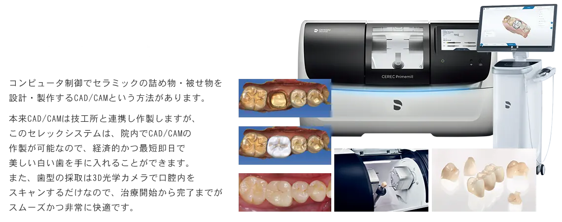 セレックシステム