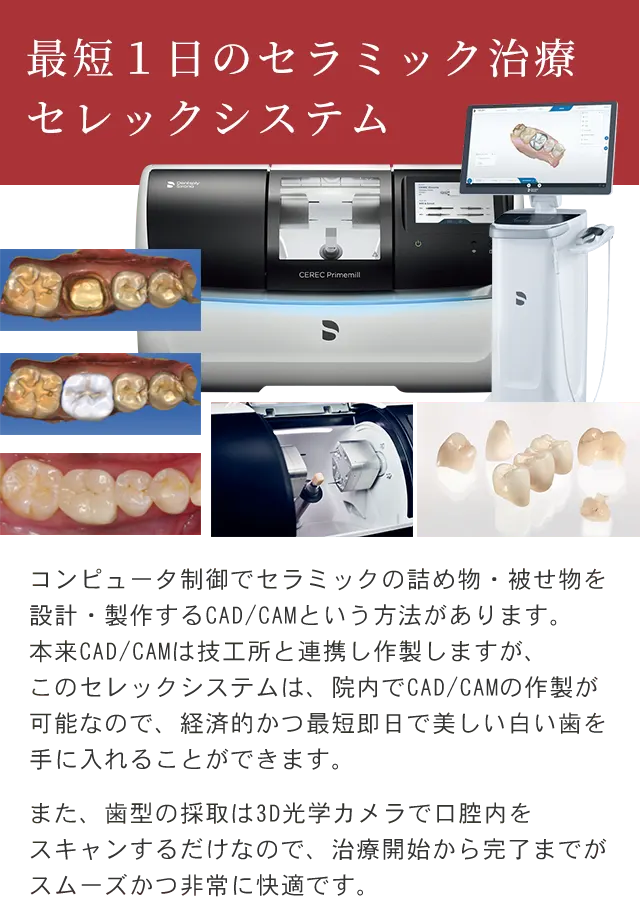 セレックシステム