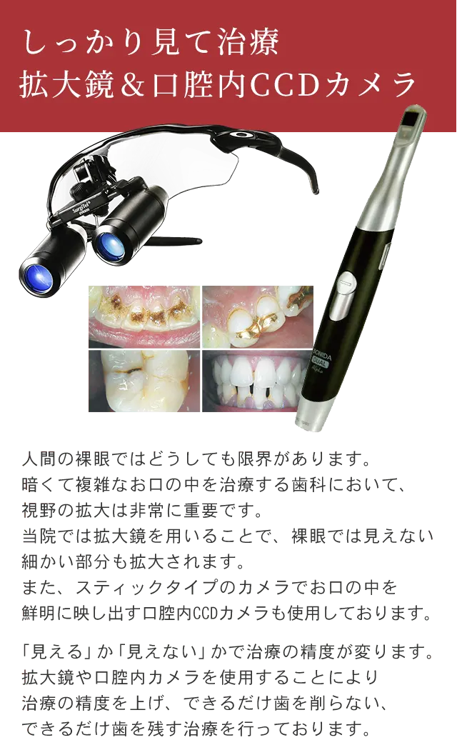 拡大鏡＆口腔内CCDカメラ