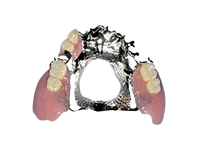 金属床（コバルトクロム）