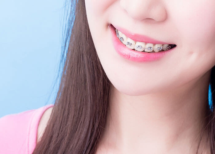 セルフライゲーション