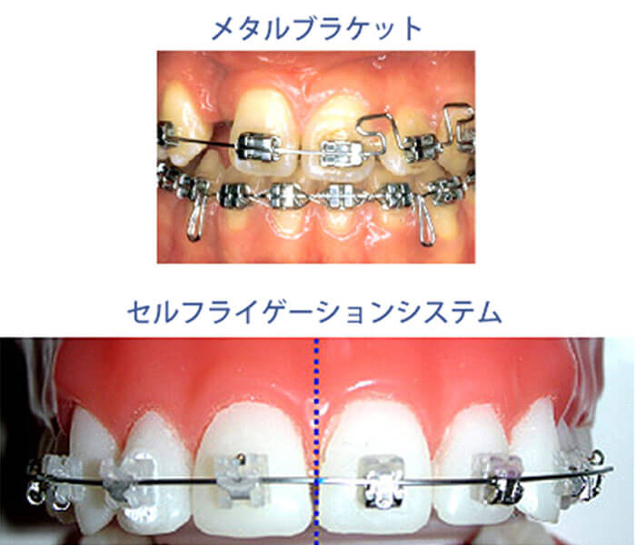 デーモンシステム
