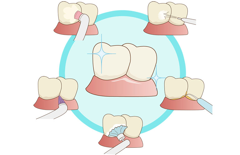 歯科衛生士によるメインテナンス