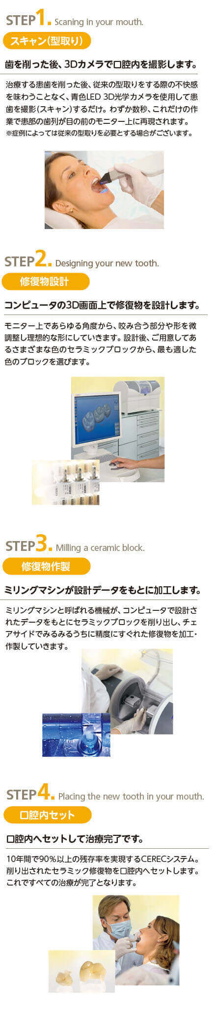 セレック治療の流れ