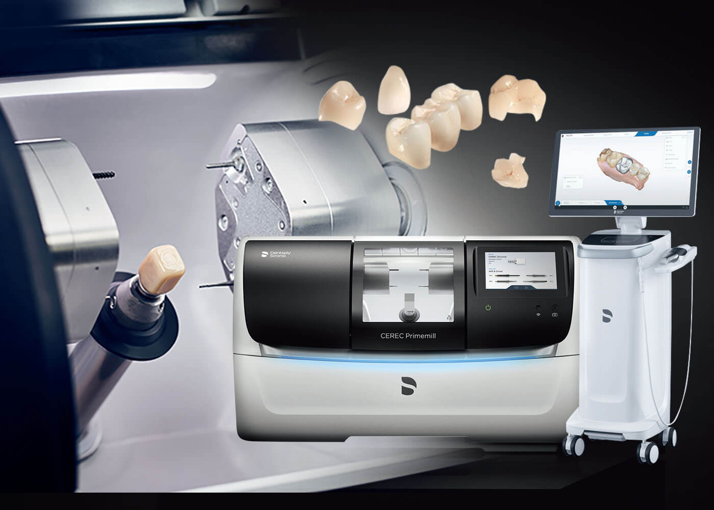 セラミック治療