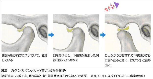 音が出る状態