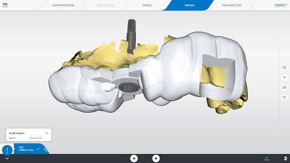 修復・埋入手術の計画 
