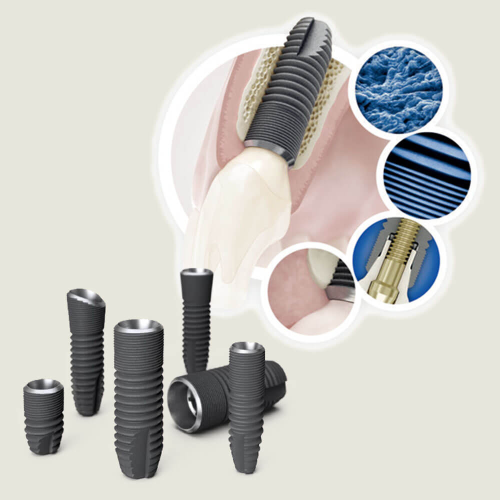 アストラインプラント