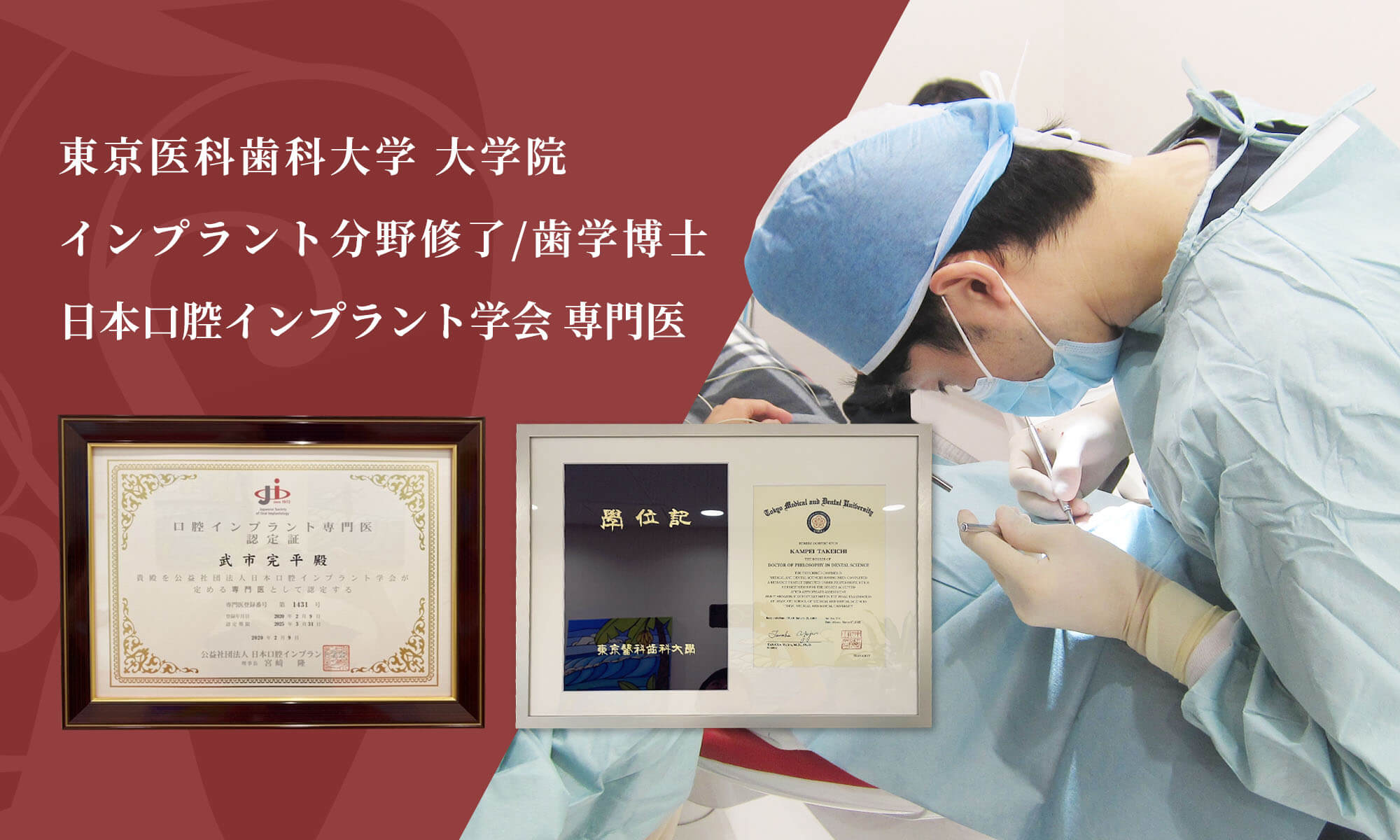 インプラント専門医が対応