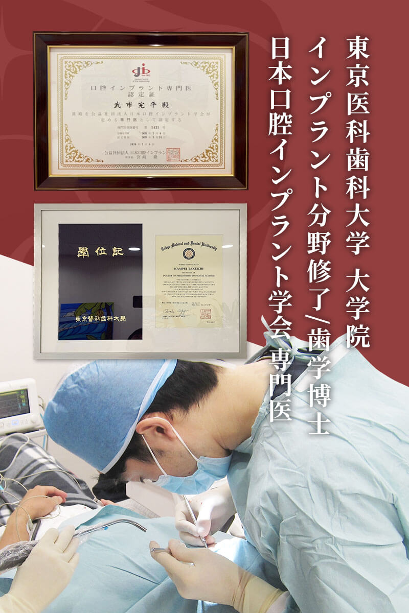 インプラント専門医が対応