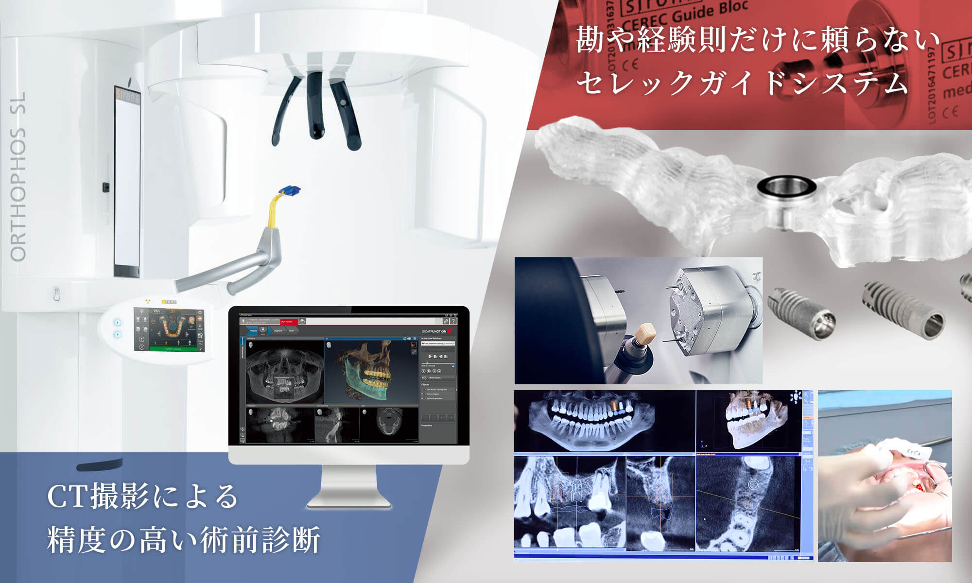 CT・セレックガイド